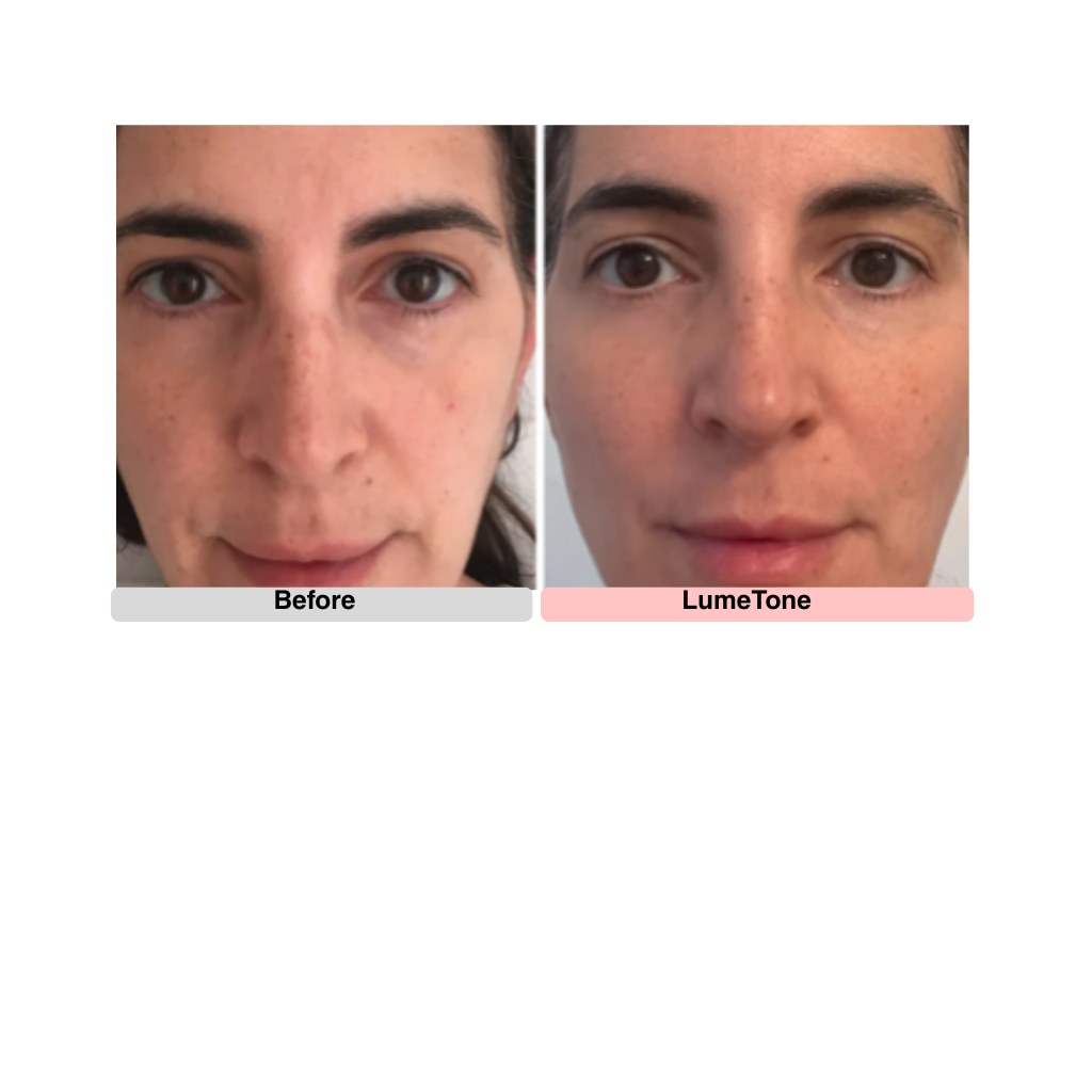 LumeTone Golden Restore