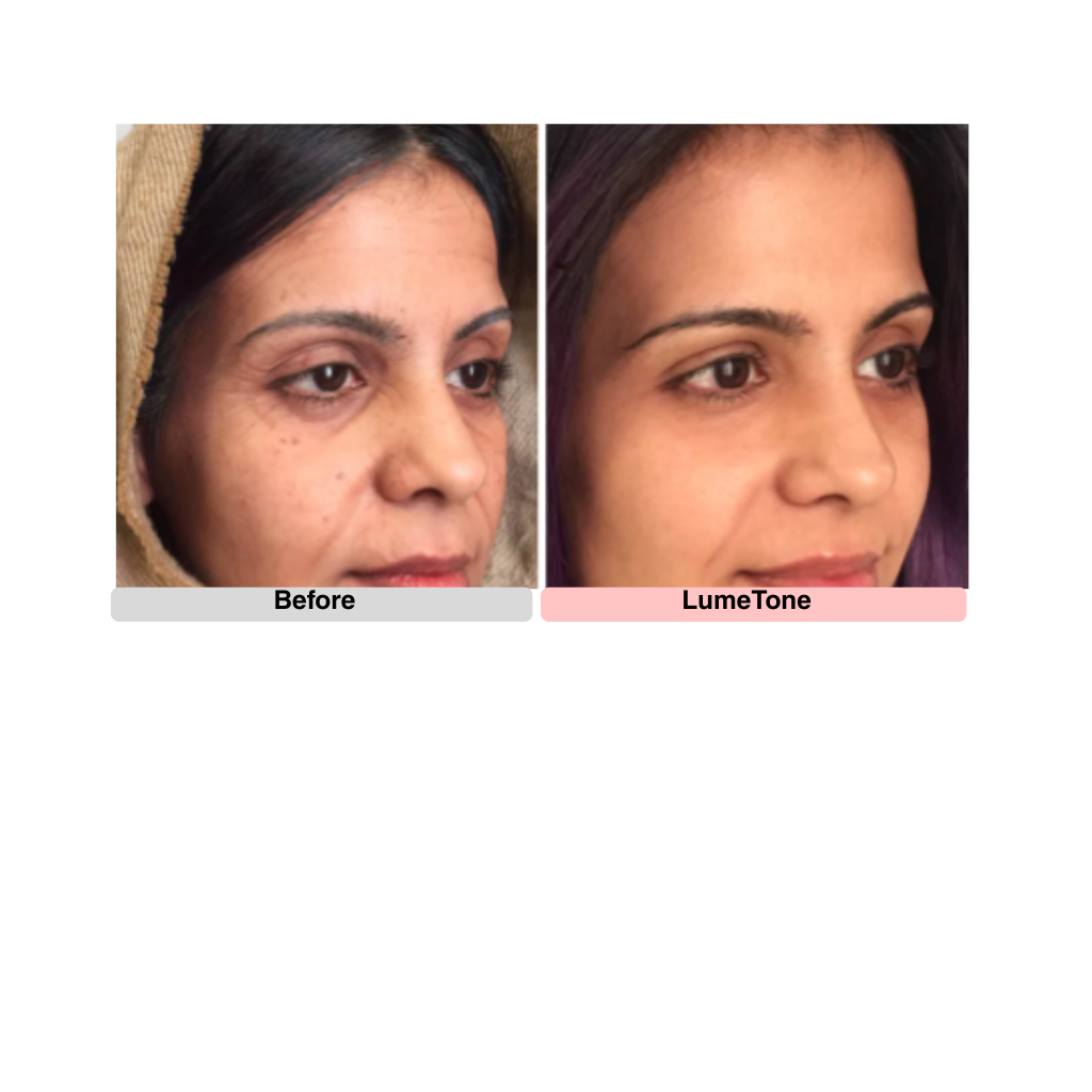 LumeTone Golden Restore