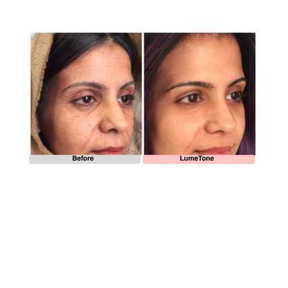 LumeTone Golden Restore