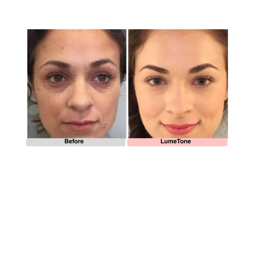 LumeTone Golden Restore