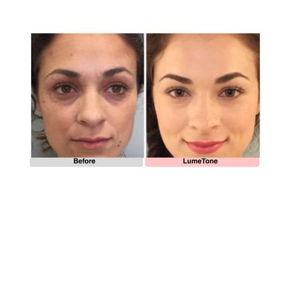 LumeTone Golden Restore